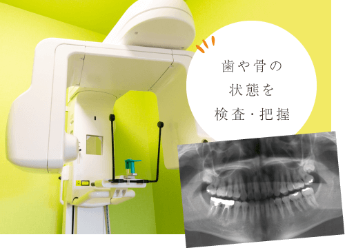 歯や骨の状態を検査・把握