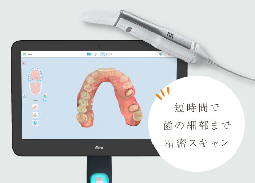 短時間で歯の細部まで精密スキャン